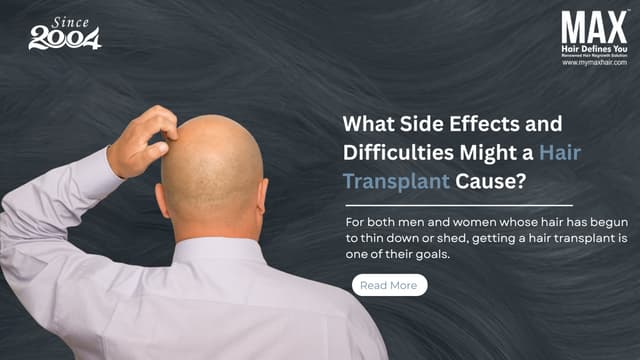 What side effects and difficulties might a hair transplant cause? Image