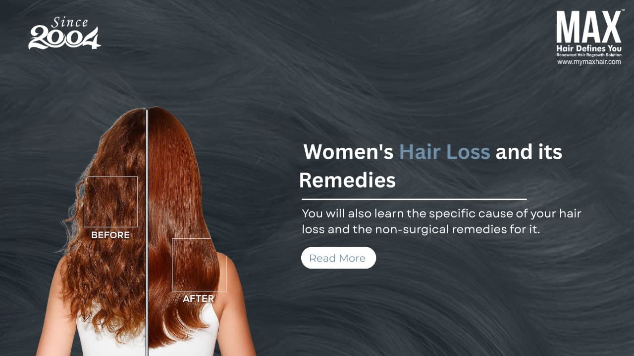 Best hair loss treatment clinic in chennai hair Loss clinic chennai