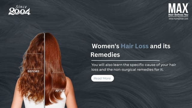 Women's hair loss and its remedies Image